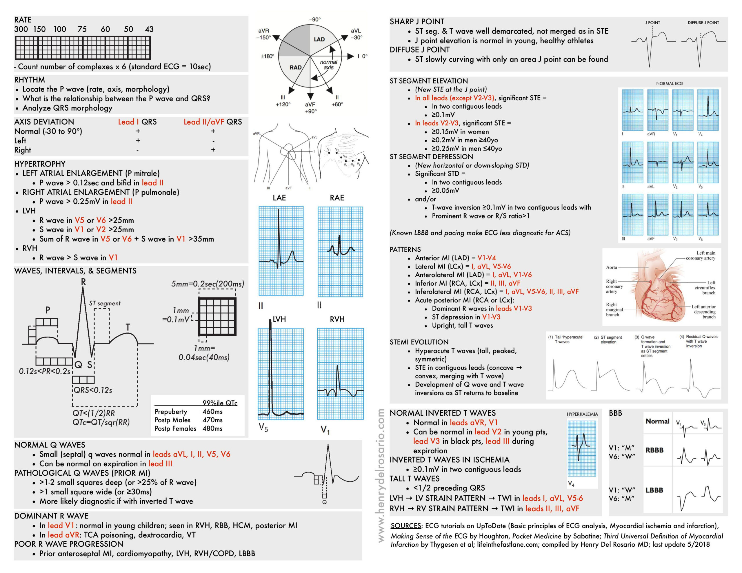 Ecg Cheat Sheet Ecg Rapid View: It Is Organized | Grepmed for Free Printable Ekg Interpretation Cheat Sheet