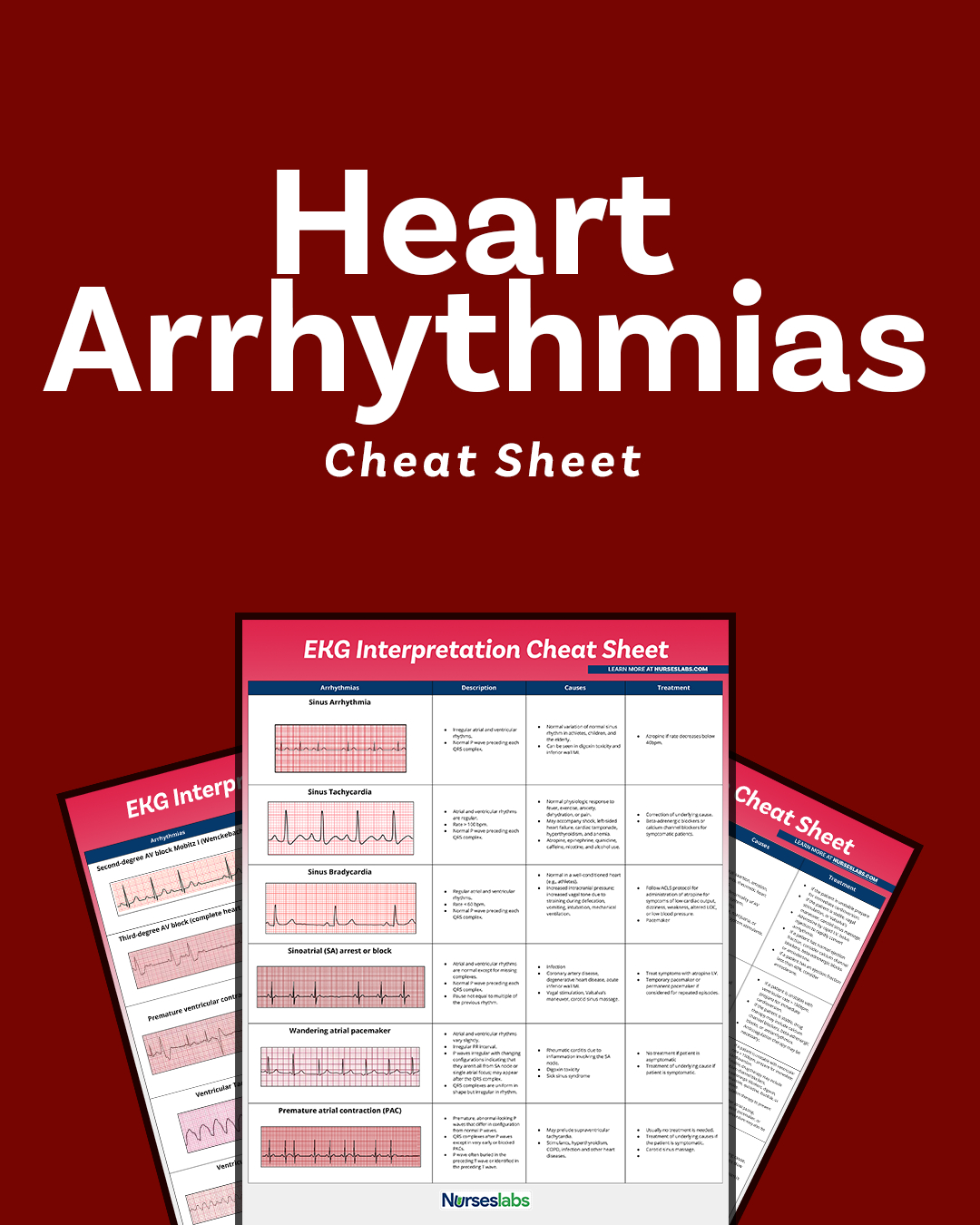 Ekg Interpretation Cheat Sheet & Heart Arrhythmias Guide (2020 Update) throughout Free Printable Ekg Interpretation Cheat Sheet